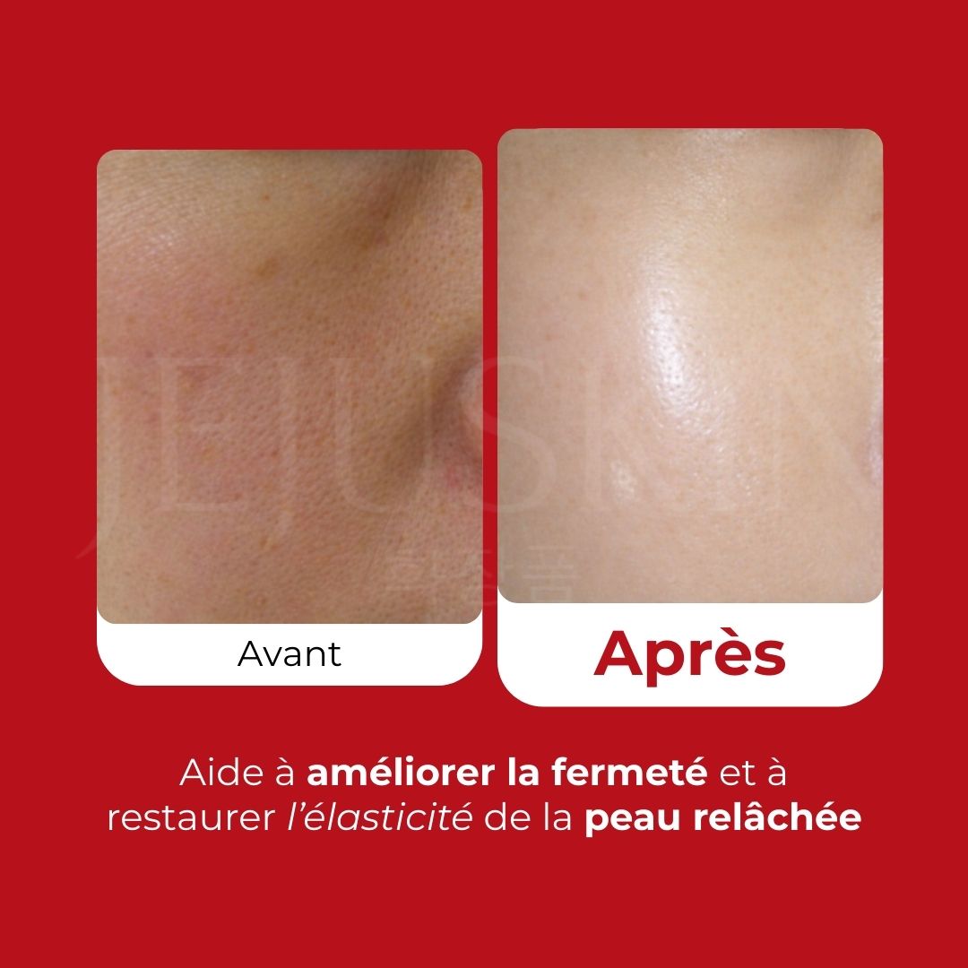 Medi-Peel — Crème de nuit au collagène Super 10 70ml (img 5)
